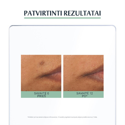 EUCERIN DERMOPURE TRIPLE EFFECT serums pūtīšu atstāto plankumu mazināšanai (66862) attēls